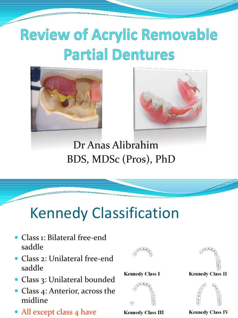 Review of Acrylic Removable Partial Dentures PDF Dentures Animal
