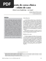 Aumento de Coroa Clinica