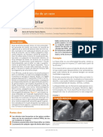 Litiasis Biliar Caso PDF