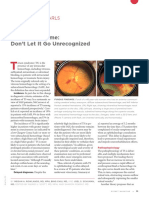 ARTICULO RETINA.pdf