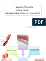 CARDIOPATIA ISQUEMICA Angina Estable, Inestable IAM Sin Elevacion ST