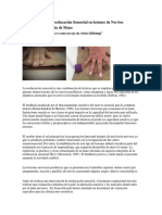 Importancia de La Reeducación Sensorial en Lesiones de Nervios Periféricos en La Terapia de Mano