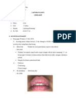 Dermatitis Perioral