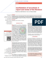 Oral Manifestation of Sarcoidosis: A Case Report and Review of The Literature