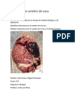 Disección de Cerebro de Vaca