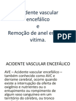 acidente vascular