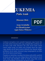 Leukimia Pada Anak