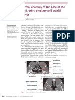 Skull Base Anatomy On CT and MRI