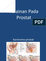 PR Komplikasi Appendisitis