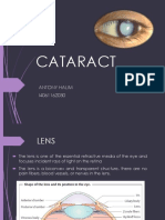 Cataract: Antony Halim I4061162030