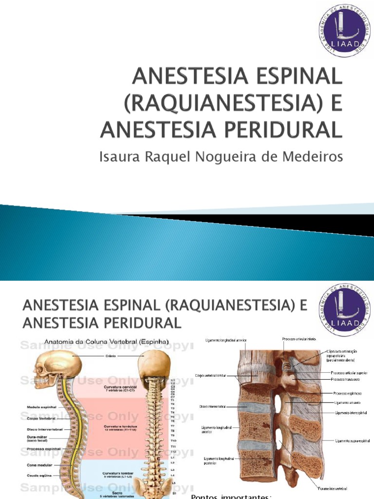 Anestesia Raquidiana e Peridural: Técnicas e Indicações | PDF ...