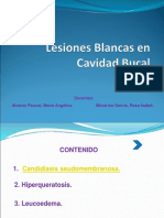 Lesiones Blancas en Cavidad Bucal