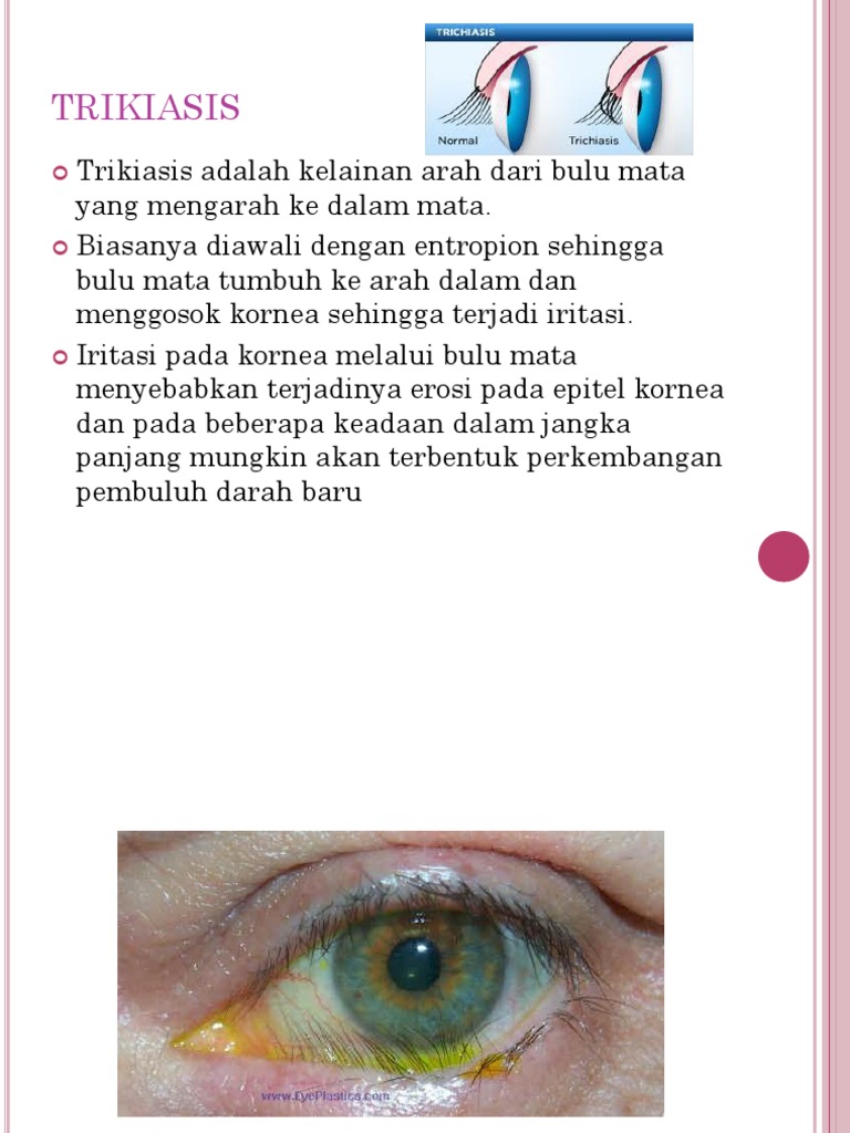 Trikiasis: Penyebab, Gejala, dan Terapi | PDF | Sains & Matematika