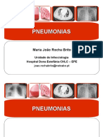 Pneumonias