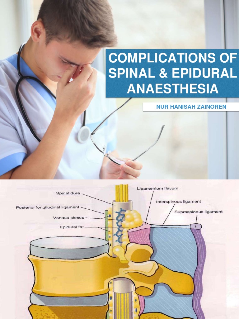 Complications of Spinal & Epidural Anesthesia | PDF | Medical ...