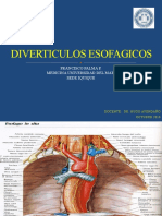Divertículos esofágicos: causas, tipos y tratamiento