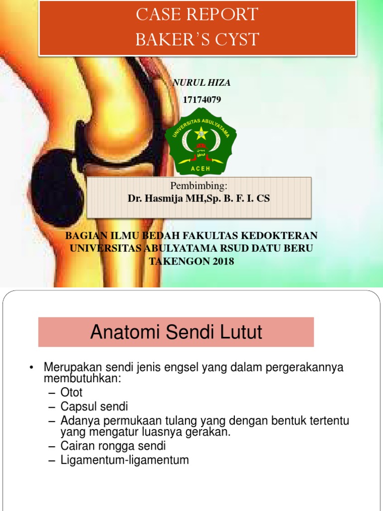 Baker Cyst Powerpoint PDF