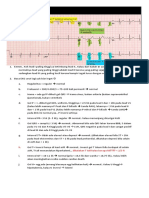 Baca Ekg Normal