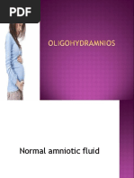 Oligohydramnios 171125104430