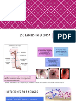 Esofagitis Infecciosa3