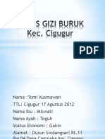 Kasus Gizi Buruk