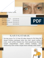 Katarak SGD