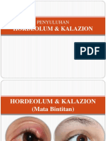 Hordeolum & Kalazion 2