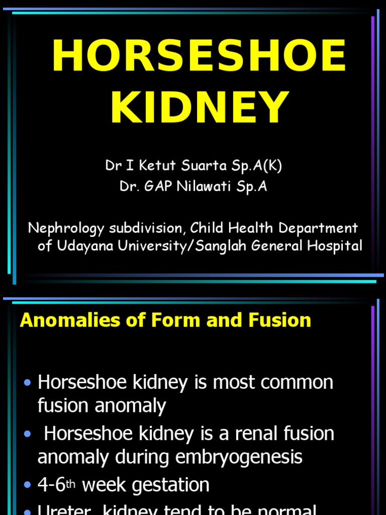 Horseshoe Kidney PDF Kidney Medical Specialties