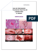 Neoplasias: Guia de Preparados Histologicos Practica de Laboratorio Iv Unidad