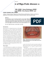 Management of Riga Fede Disease A Case Report PDF