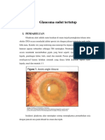Glaucoma akut sudut tertutup.docx