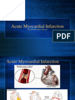 Acute_MI- KUL 6FEB'19.pdf