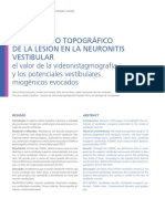 DX Topografico Neuronite Vestibular