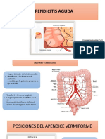 Apendicitis Aguda