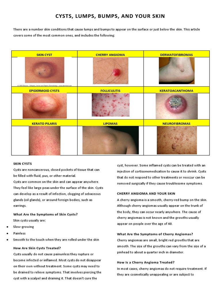 Skin Lumps, Cyst, Bumps | PDF | Shaving | Medical Specialties