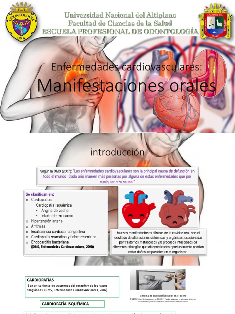 Manifestaciones Orales de Enfermedades Cardiovasculares | PDF ...