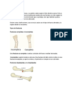 Tipos de fracturas óseas: clasificación y descripción