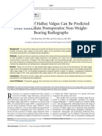 La Recurrencia de Hallux Valgus Puede Predecirse A Partir de Radiografías Postoperatorias Inmediatas Sin Soporte de Peso PDF