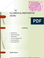 Acute Glomerulonephritis (AGN) : Paediatric Department CME