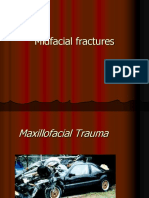 Maxilla Trauma Class