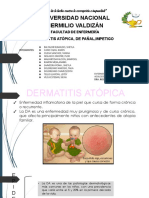 Dermatitis, Atopica, de Pañl, Impetigo