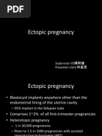 Ectopic Pregnancy William 24th