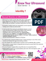 Normal Ovaries On Ultrasound