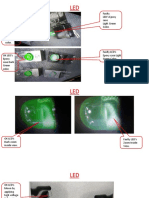 Faulty LED's Epoxy Case Light Green Color. Ok Led'S Epoxy Case Dark Green Color