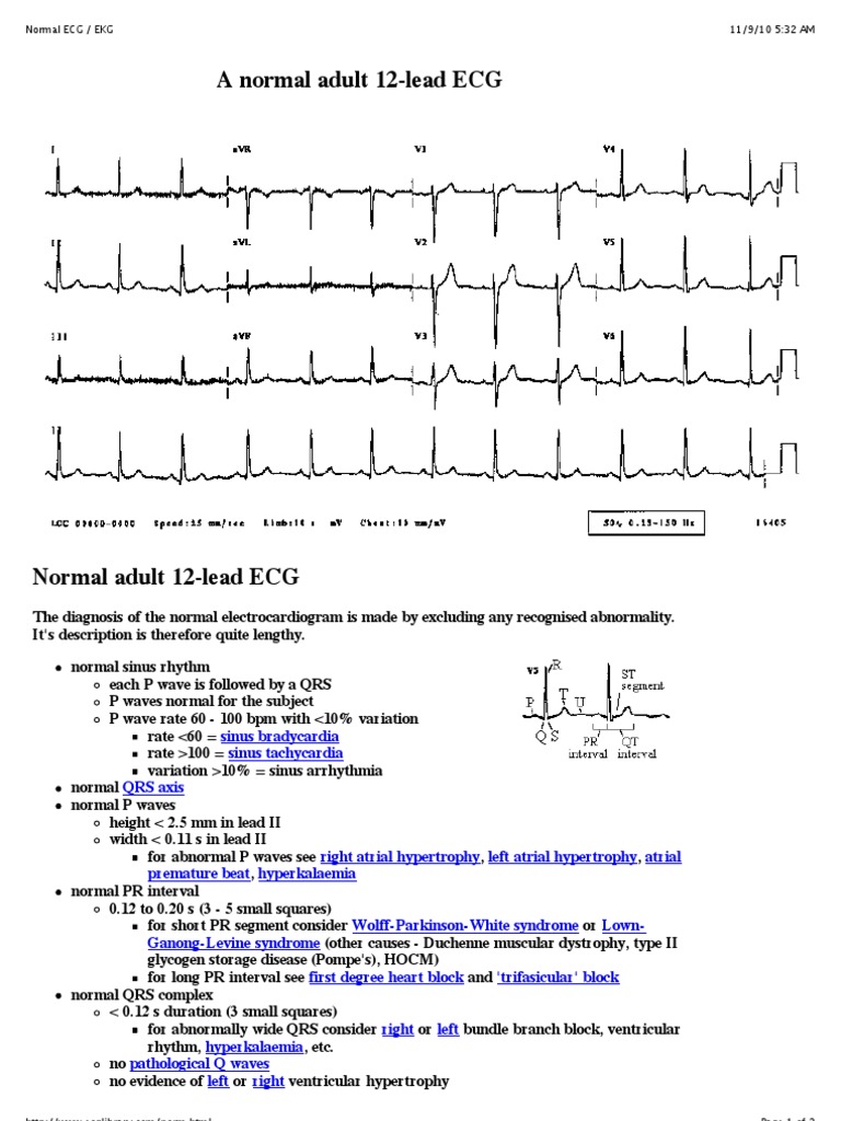 Normal Ecg - Ekg | PDF | Electrocardiography | Electrophysiology