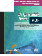 De Quervain S Tenosynovitis PDF