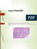 Lupus Nephritis: Diagnosis and Management
