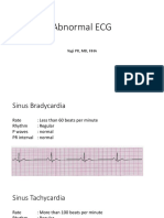 Abnormal ECG 1.pptx