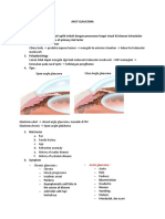 Akut Glaucoma