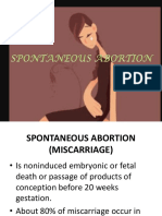'Spontaneous Abortion ': - By: Charisse Asda Woo, RM